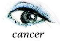 cancer